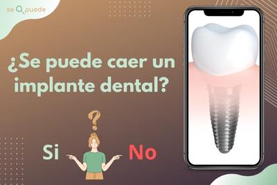 ¿Se puede caer un implante dental?