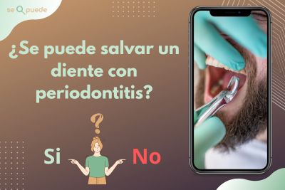 ¿Se puede salvar un diente con periodontitis?